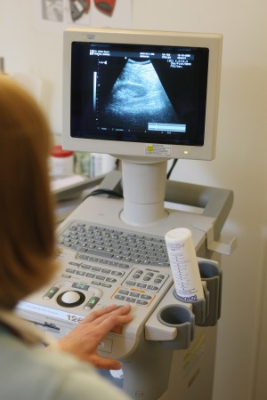ultrasound machine rental